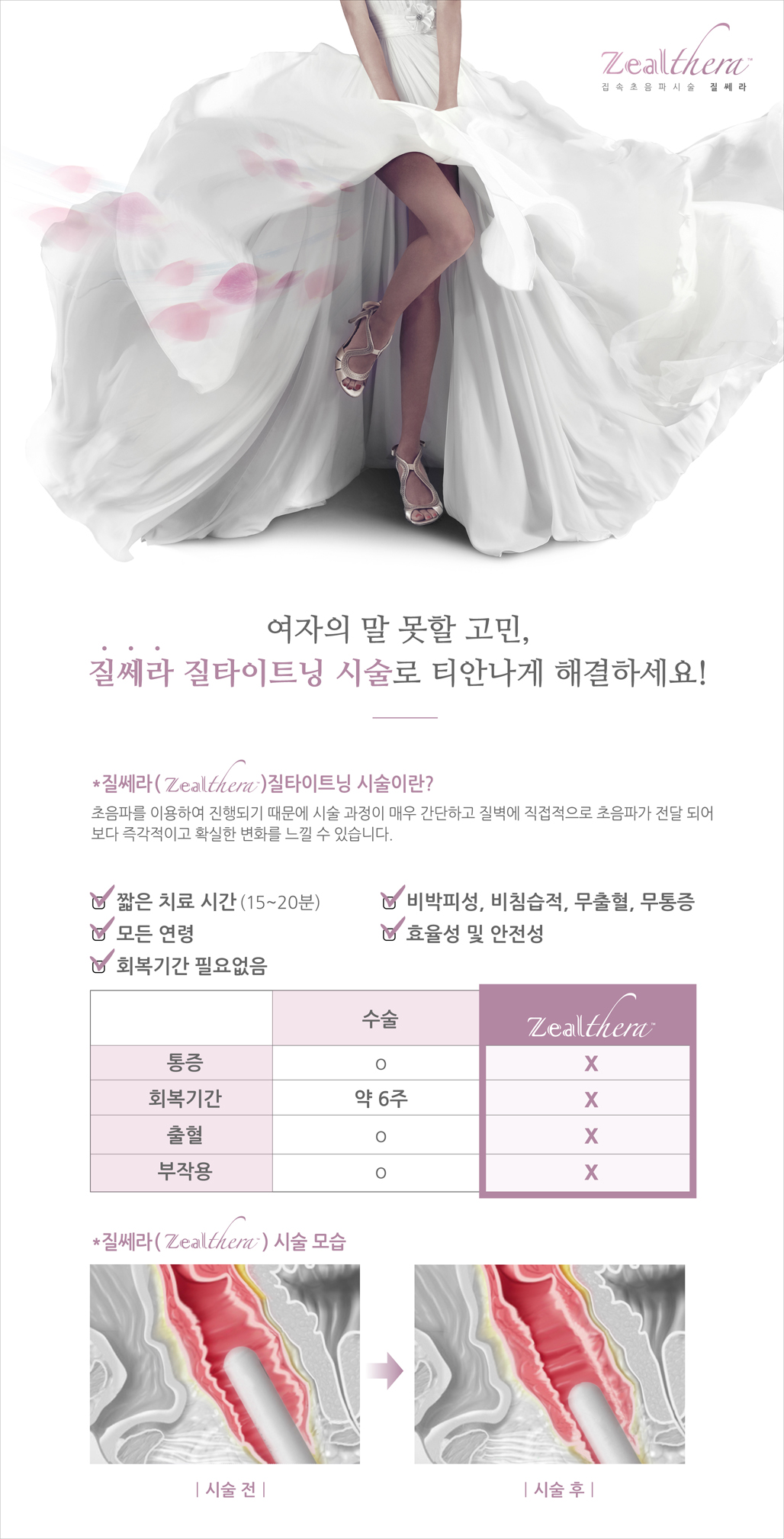 질세라